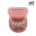 P/E TIPODONTO CON BRACKET EMPOWER