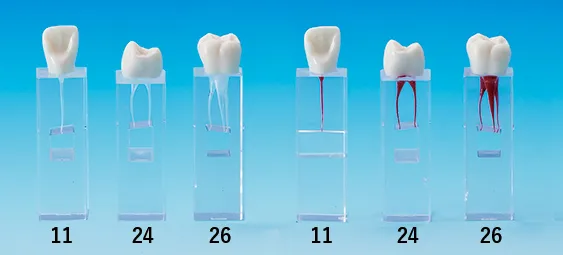 CONDUCTO RADICULAR NISSIN